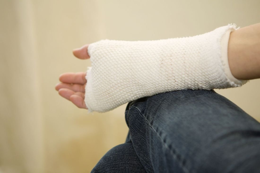 The Difference Between A Fracture And A Sprain Ortho El Paso