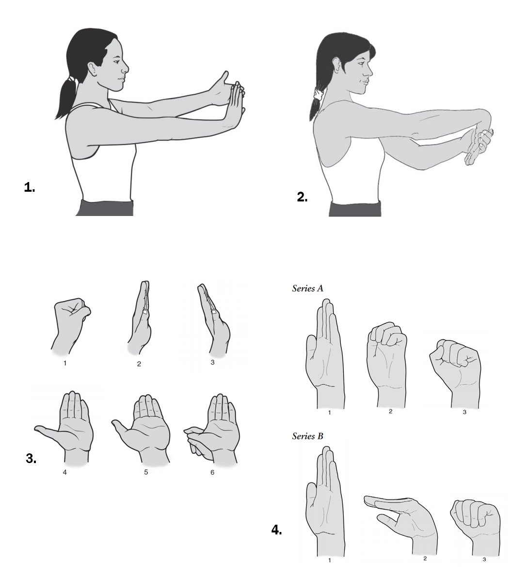 Carpal Tunnel Syndrome Rehab Exercises